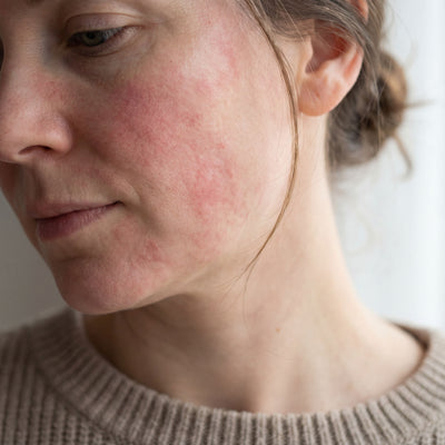 Retinol products can be too harsh for daily use