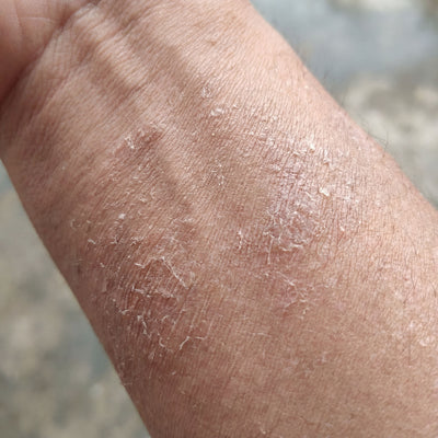 Results fade when the skin barrier isn’t supported